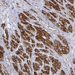TIS11D Antibody, Novus Biologicals 0.1mL; Unlabeled:Antibodies, Polyclonal